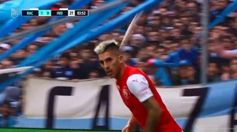 В Аргентине игрок получил рыбой по лицу во время матча. Ему понадобилась скорая